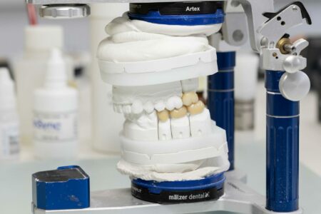 Passgenauer Aufbau keramischer Zähne in das Gebissmodell des Patienten.